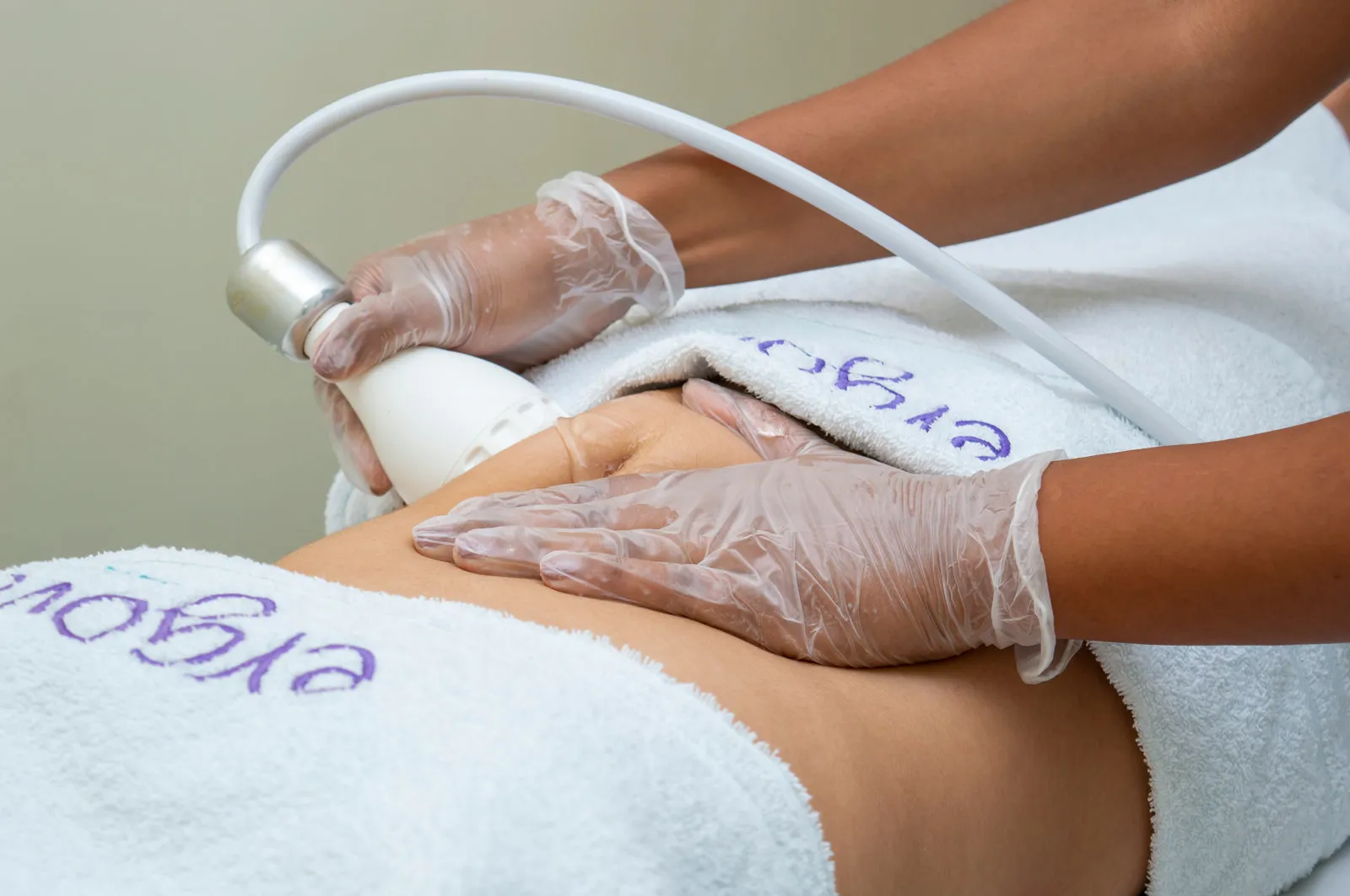 Aparelho de estética corporal sendo aplicado na barriga de uma cliente na Ergon Saúde, em Sorocaba